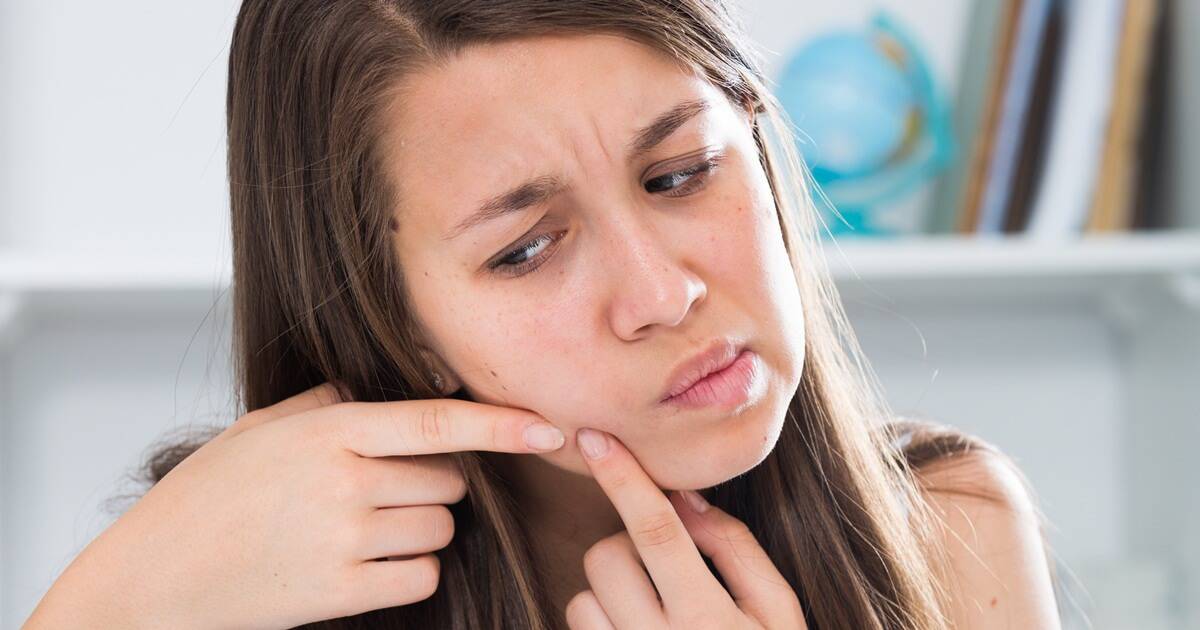 ข้อควรรู้เกี่ยวกับโพรไบโอติก และการรักษาสิว