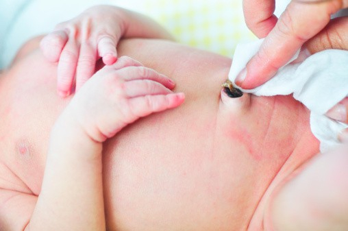 สะดือจุ่น เป็นอันตรายต่อสุขภาพเด็กหรือไม่