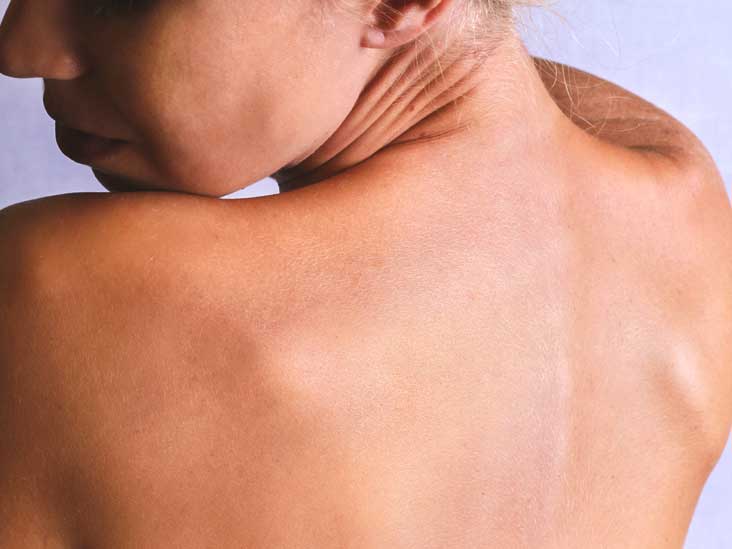 สาเหตุที่พบบ่อยของโรคผิวหนังอักเสบ