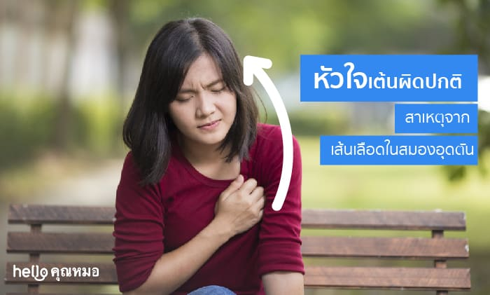 หัวใจเต้นผิดปกติ อาจมีสาเหตุมาจากเส้นเลือดในสมองอุดตันก็ได้