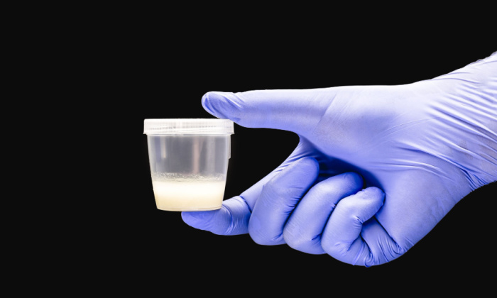 ภาวะจำนวนอสุจิน้อย สาเหตุ อาการ และการรักษา