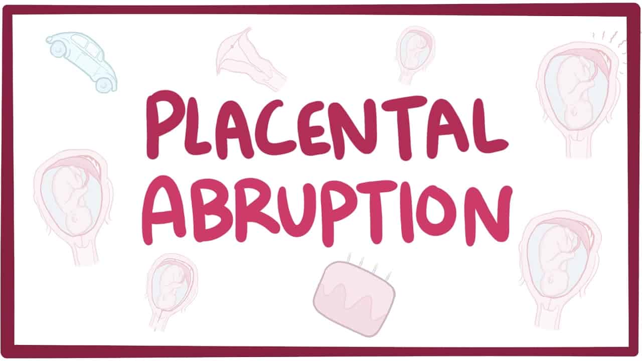 ภาวะรกลอกตัวก่อนกำหนด อาการ สาเหตุ และการรักษา