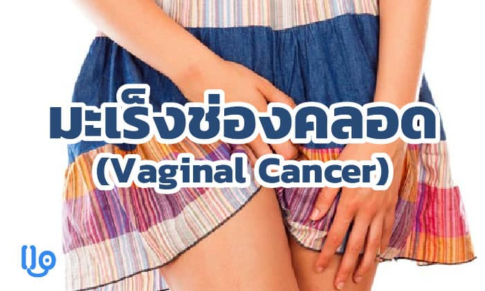มะเร็งช่องคลอด (Vaginal Cancer) มะเร็งที่สาว ๆ ควรทำความรู้จัก
