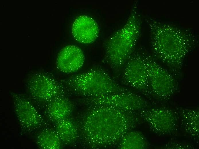 ทดสอบแอนตี้บอดี้-โจ-1 (Anti-Jo-1 Antibodies Test)