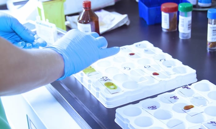 รู้หรือไม่? การตรวจหาปริมาณ ไวรัสในเลือด สำคัญกว่าที่คิด