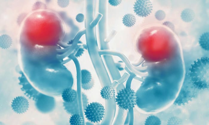 มะเร็งท่อไต (Ureteral Cancer)