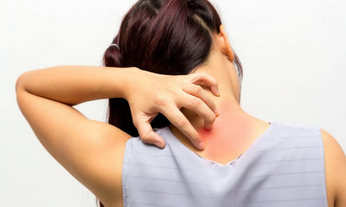 เบาหวานกับผิวหนัง ทำไมจึงเกิดอาการคันและติดเชื้อง่าย