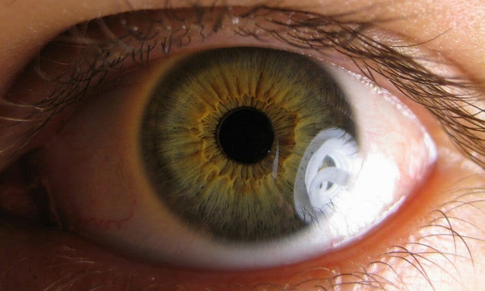 ปัญหาสุขภาพตา ที่พบได้บ่อยในผู้ป่วยเบาหวาน