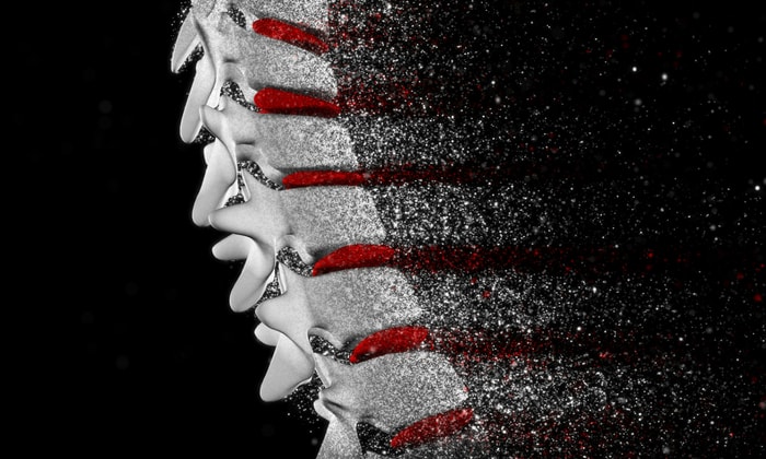 กระดูกบาง (Osteopenia)