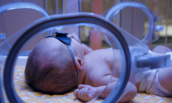 โรคดีซ่านในเด็ก สาเหตุและการรักษา