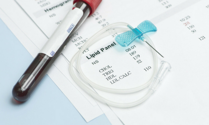 สิ่งที่ควรรู้เกี่ยวกับ การตรวจคอเลสเตอรอล