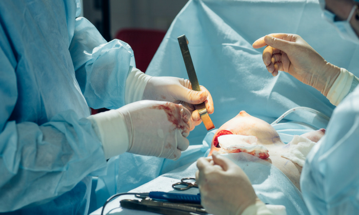 รักษามะเร็งเต้านมด้วย การผ่าตัดแบบสงวนเต้านม เป็นอย่างไร