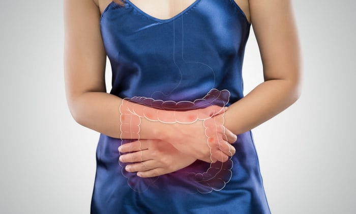 ลำไส้ใหญ่อักเสบ (Colitis)