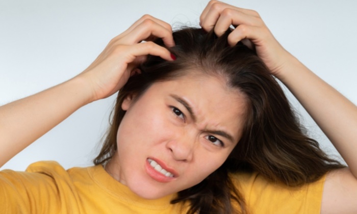 หนังศีรษะแห้ง สาเหตุ และวิธีรับมือ