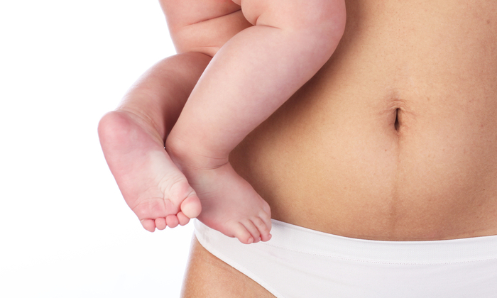 ลดหน้าท้องหลังคลอด อย่างไรให้ปลอดภัย