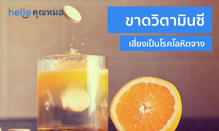 ระวังให้ดี ขาดวิตามินซี โรคโลหิตจาง จะถามหา