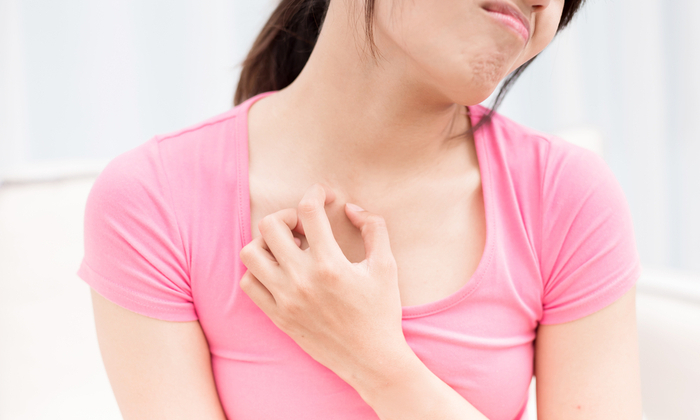 ลมพิษ มีสาเหตุจากอะไร และรักษาอย่างไร