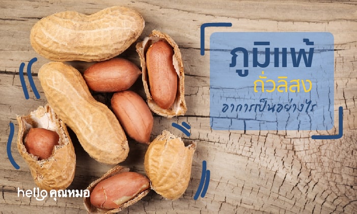 ภูมิแพ้ถั่วลิสง (Peanut Allergy)