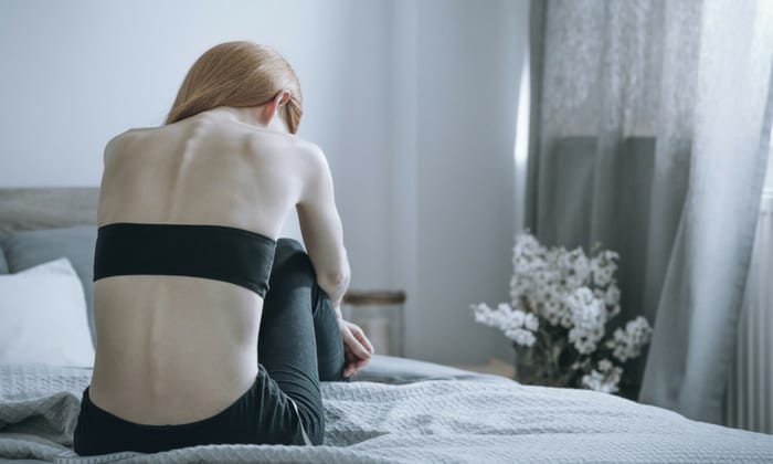 อะนอเร็กเซีย เนอร์โวซ่า (Anorexia Nervosa)