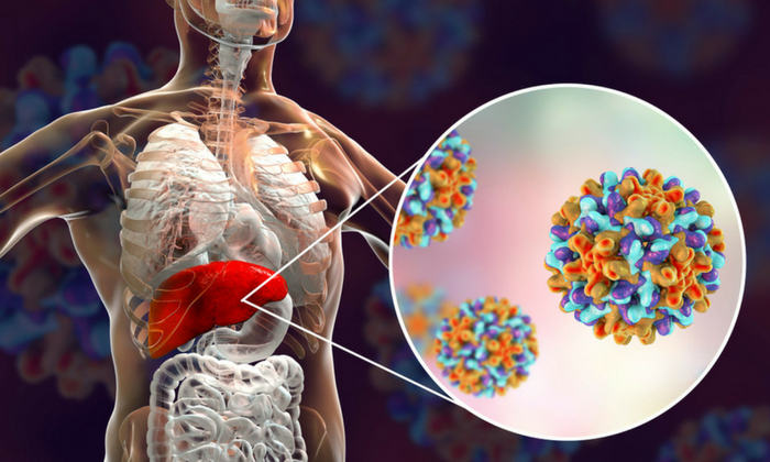 ตับอักเสบ บี (Hepatitis B)