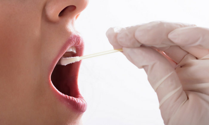 ไลเคนพลานัสในช่องปาก (Oral Lichen Planus)