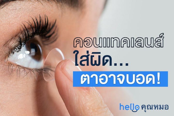 คอนแทคเลนส์ และสิ่งที่ไม่ควรทำ หากไม่อยากให้ดวงตามีปัญหา