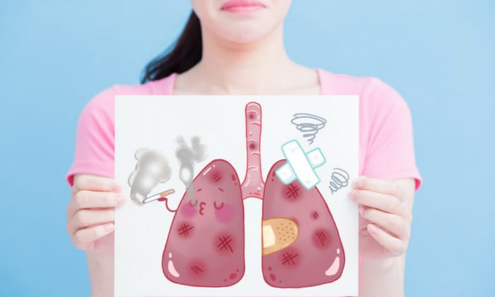 การรับรู้ ระยะของโรคมะเร็งปอด ช่วยคุณสู้มะเร็งได้อย่างไร