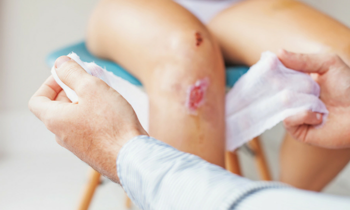 แผลติดเชื้อ (wound infection)