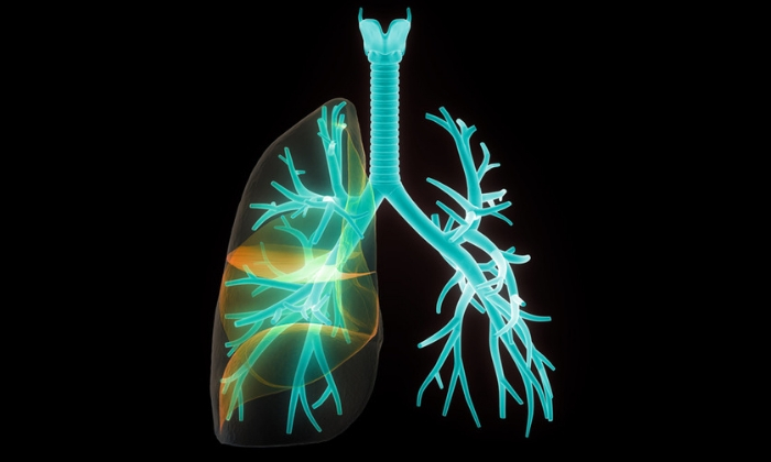 หลอดลมฝอยอักเสบเฉียบพลัน (Acute Bronchiolitis)