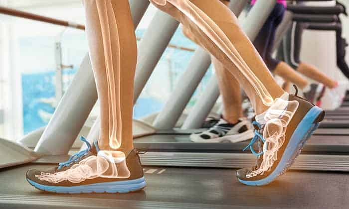 วิ่ง ยังไงให้ได้ประโยชน์สูงสุดต่อกระดูกของคุณ