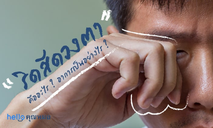 ริดสีดวงตา (Trachoma)