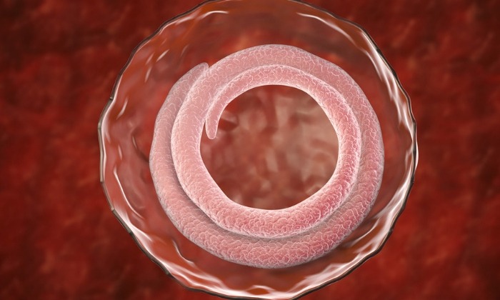 โรคทริคิโนซิส (Trichinosis)