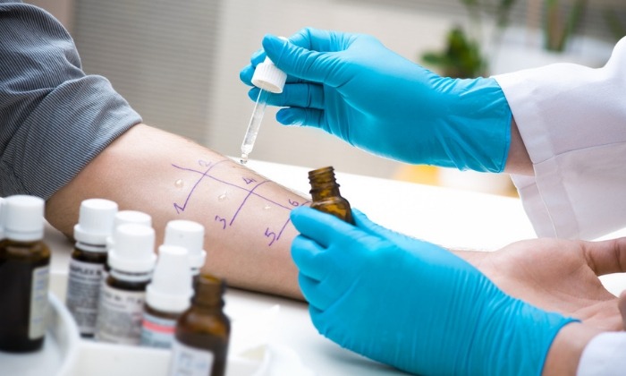 การทดสอบภูมิแพ้ทางผิวหนัง ข้อมูลที่ควรรู้ก่อนรับการทดสอบ