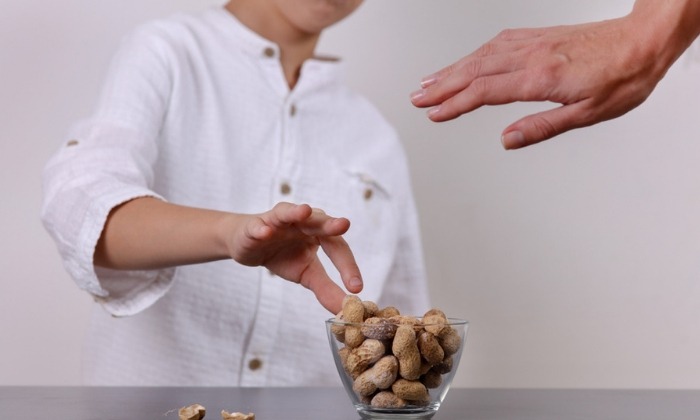 ข้อเท็จจริงเกี่ยวกับ การแพ้อาหาร ที่พ่อแม่ควรรู้