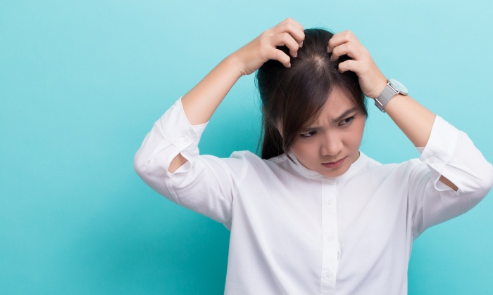 รังแคในหน้าหนาว สาเหตุ และการป้องกัน