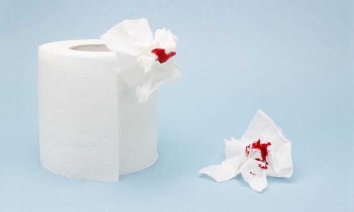 ถ่ายเป็นเลือด (Rectal Bleeding)
