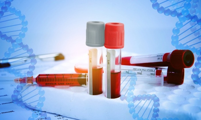 โรคเลือด อาการ สาเหตุ การรักษา