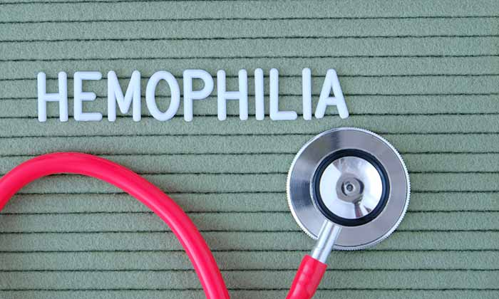 ฮีโมฟีเลีย (Hemophilia)