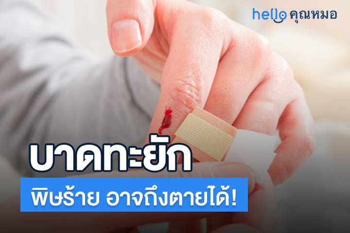 ทำความรู้จักกับ โรคบาดทะยัก เพื่อให้รับมือโรคอันตรายนี้ได้ทัน