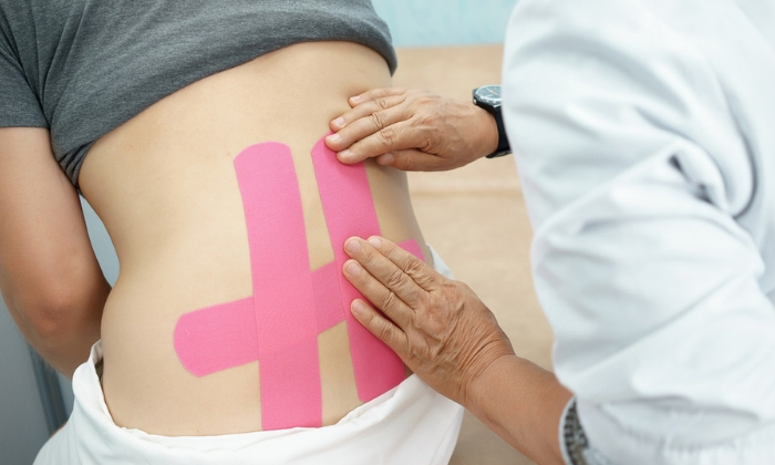 ผ้าเทปบำบัดคิเนซิโอ อีกหนึ่งเทคนิคในการบำบัดอาการปวดหลัง