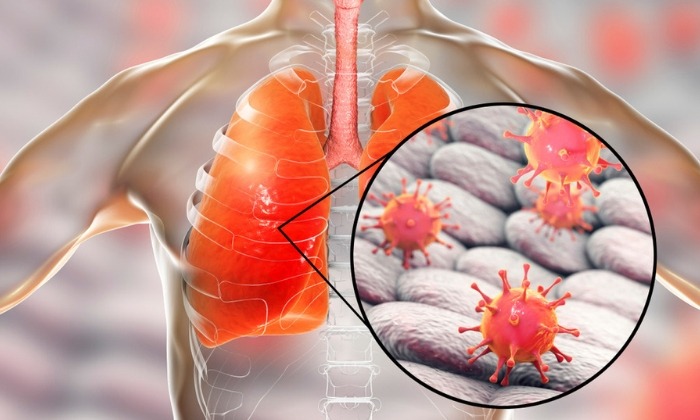 โรคซาร์ส (SARS) หรือโรคทางเดินหายใจเฉียบพลันรุนแรง (Severe Acute Respiratory Syndrome)