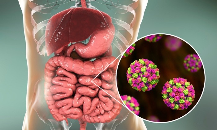 กระเพาะอาหารและลำไส้อักเสบ อาการ สาเหตุ และการรักษา