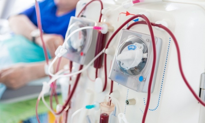ฟอกไต (Kidney Dialysis)