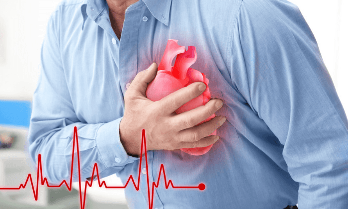 กล้ามเนื้อหัวใจตายเฉียบพลัน (Acute Myocardial Infarction)