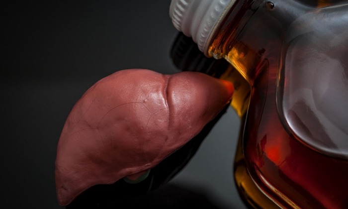 ตับแข็งจากแอลกอฮอล์ (Alcoholic liver cirrhosis)