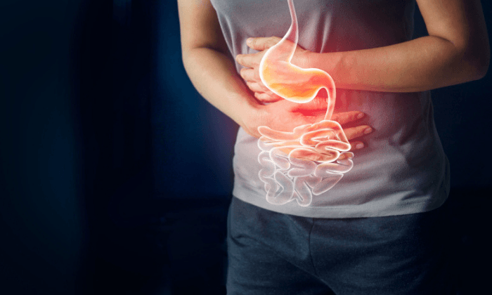 ไส้ติ่งอักเสบ (Appendicitis)