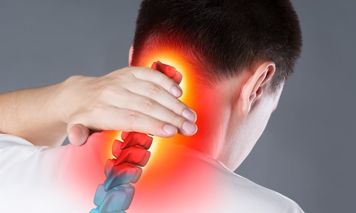 หมอนรองกระดูกคอทับเส้นประสาท (Cervical herniated disc)