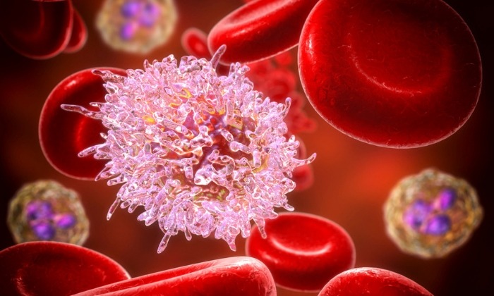 มะเร็งเม็ดเลือดขาวลิมโฟไซต์แบบเรื้อรัง (Chronic Lymphocytic Leukemia)