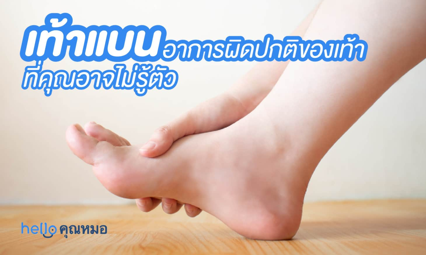 เท้าแบน อาการผิดปกติของเท้าที่คุณอาจไม่รู้ตัว และอาจก่อปัญหามากกว่าที่คิด