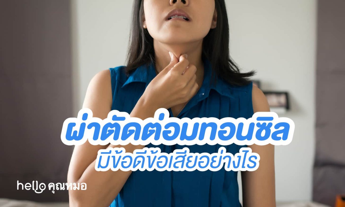 ต่อมทอนซิล ผ่าตัดต่อมทอนซิลมีข้อดีข้อเสียอย่างไร..มาดูกัน